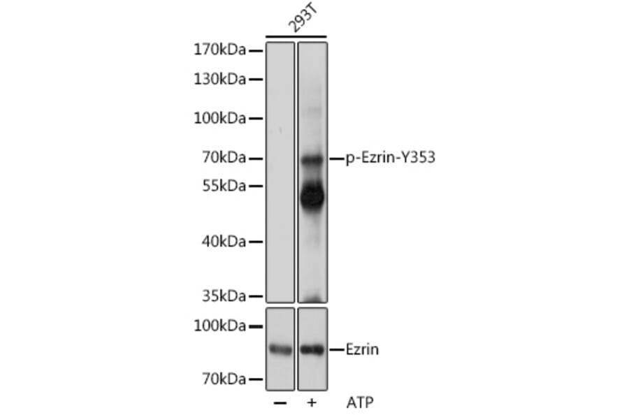 Western Blot - Anti-Ezrin (phospho Tyr353) Antibody (A308302) - Antibodies.com