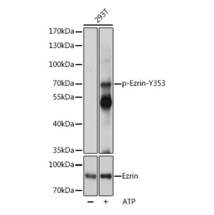 Western Blot - Anti-Ezrin (phospho Tyr353) Antibody (A308302) - Antibodies.com