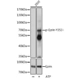 Western Blot - Anti-Ezrin (phospho Tyr353) Antibody (A308302) - Antibodies.com