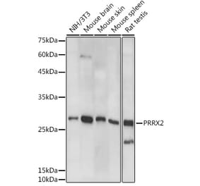 Western Blot - Anti-PRX-2 Antibody (A308303) - Antibodies.com