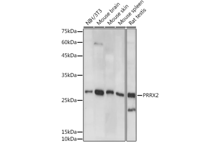 Western Blot - Anti-PRX-2 Antibody (A308303) - Antibodies.com