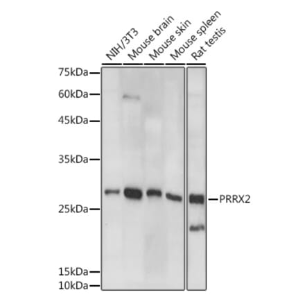 Western Blot - Anti-PRX-2 Antibody (A308303) - Antibodies.com