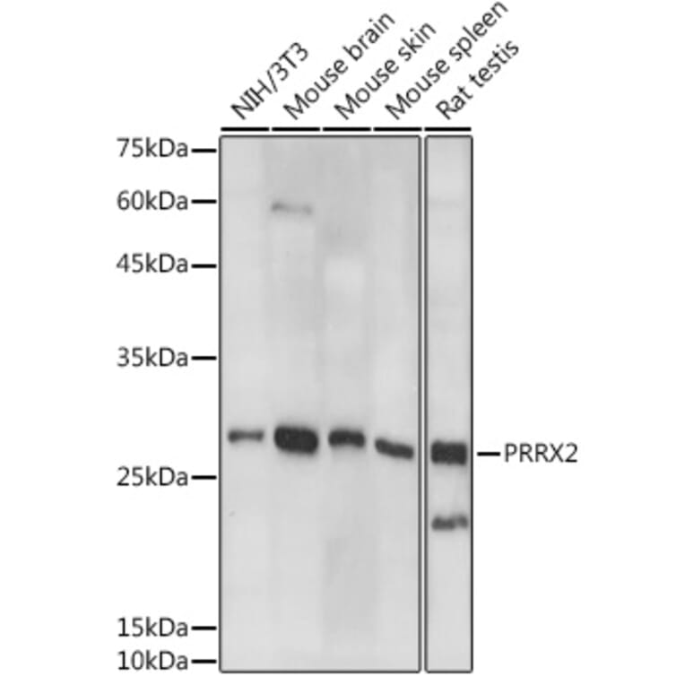 Western Blot - Anti-PRX-2 Antibody (A308303) - Antibodies.com