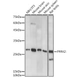 Western Blot - Anti-PRX-2 Antibody (A308303) - Antibodies.com