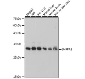 Western Blot - Anti-SNRPA1 Antibody [ARC2532] (A308304) - Antibodies.com