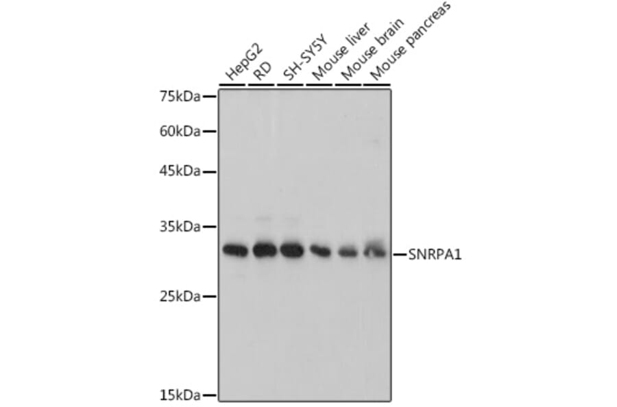 Western Blot - Anti-SNRPA1 Antibody [ARC2532] (A308304) - Antibodies.com