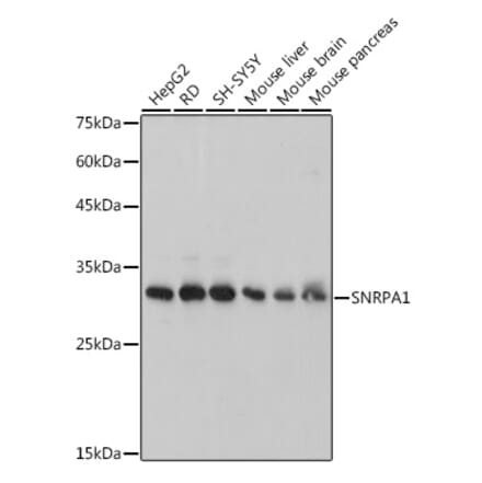 Western Blot - Anti-SNRPA1 Antibody [ARC2532] (A308304) - Antibodies.com