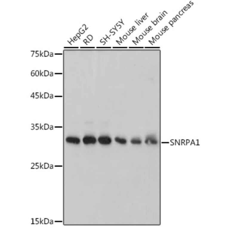 Western Blot - Anti-SNRPA1 Antibody [ARC2532] (A308304) - Antibodies.com