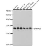 Western Blot - Anti-SNRPA1 Antibody [ARC2532] (A308304) - Antibodies.com