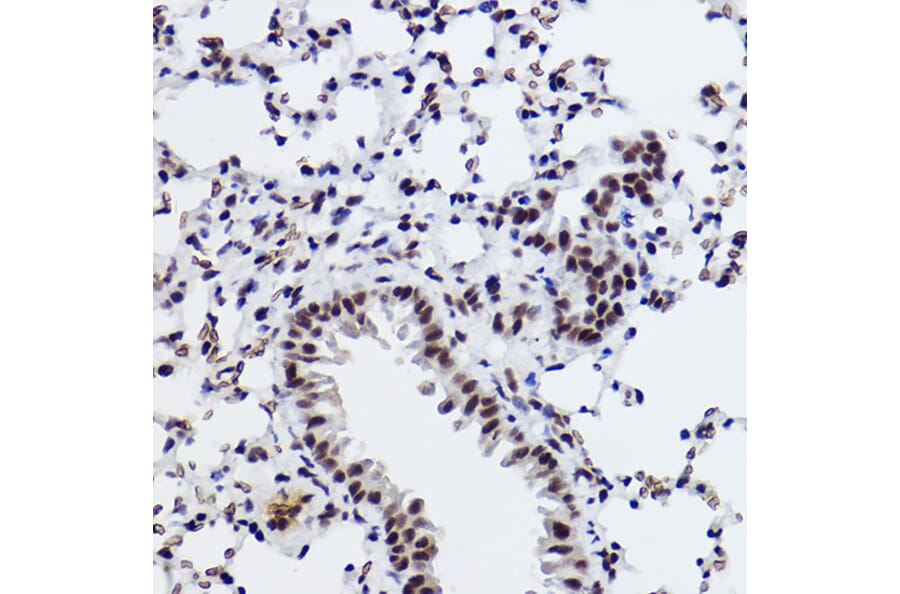 Immunohistochemistry - Anti-SNRPA1 Antibody [ARC2532] (A308304) - Antibodies.com