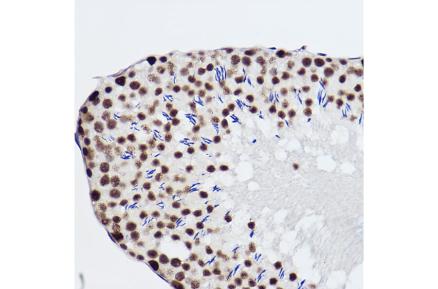 Immunohistochemistry - Anti-SNRPA1 Antibody [ARC2532] (A308304) - Antibodies.com