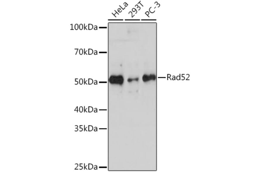 Western Blot - Anti-RAD52 Antibody [ARC1183] (A308307) - Antibodies.com