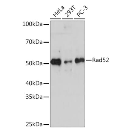 Western Blot - Anti-RAD52 Antibody [ARC1183] (A308307) - Antibodies.com
