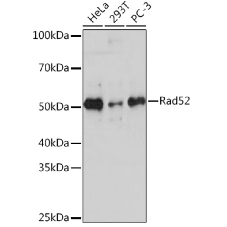 Western Blot - Anti-RAD52 Antibody [ARC1183] (A308307) - Antibodies.com