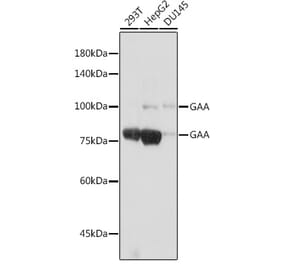 Western Blot - Anti-GAA Antibody [ARC2392] (A308308) - Antibodies.com