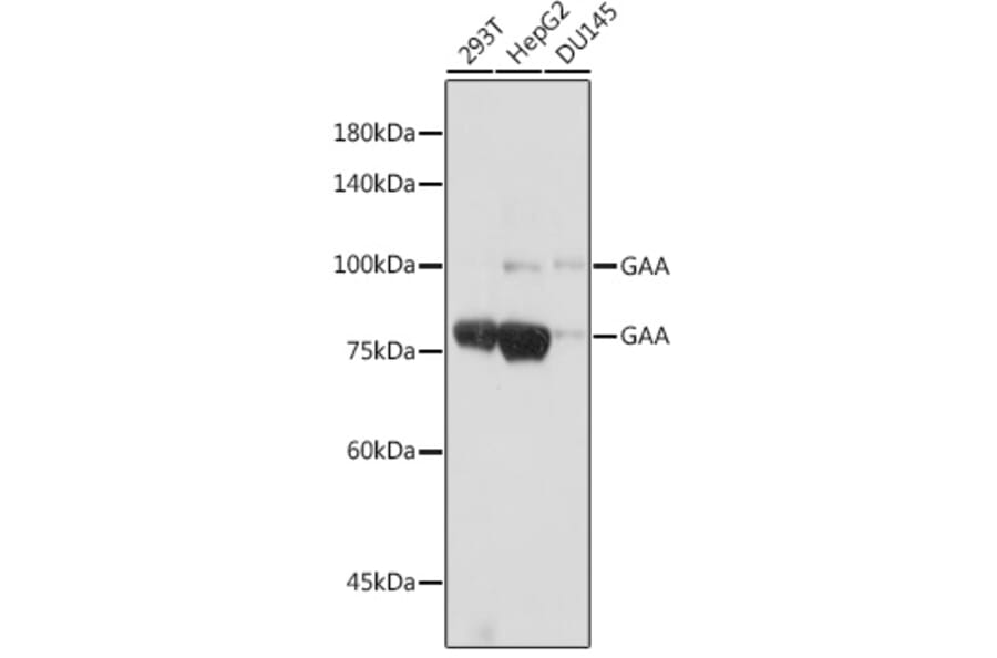 Western Blot - Anti-GAA Antibody [ARC2392] (A308308) - Antibodies.com