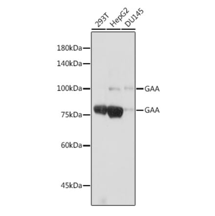 Western Blot - Anti-GAA Antibody [ARC2392] (A308308) - Antibodies.com