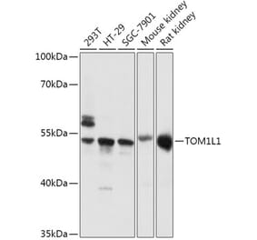 Western Blot - Anti-TOM1L1 Antibody (A308309) - Antibodies.com