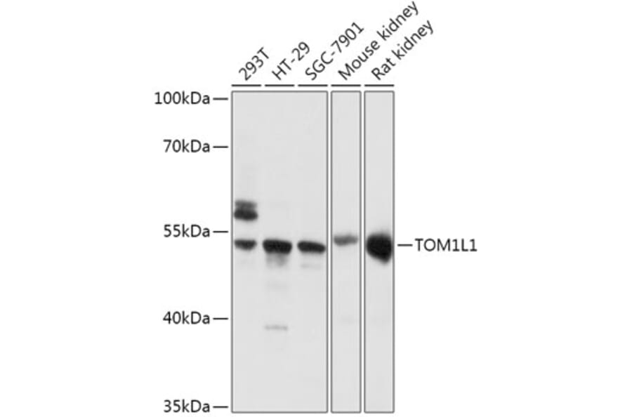 Western Blot - Anti-TOM1L1 Antibody (A308309) - Antibodies.com