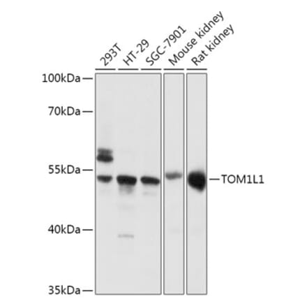 Western Blot - Anti-TOM1L1 Antibody (A308309) - Antibodies.com