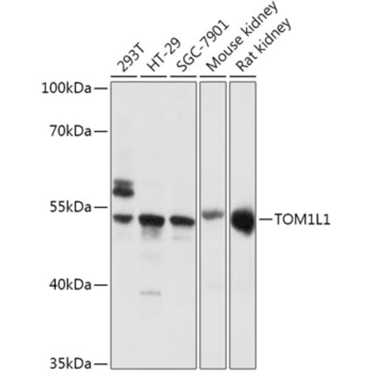 Western Blot - Anti-TOM1L1 Antibody (A308309) - Antibodies.com