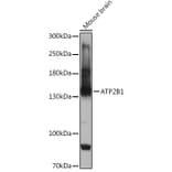 Western Blot - Anti-PMCA1 Antibody (A308310) - Antibodies.com