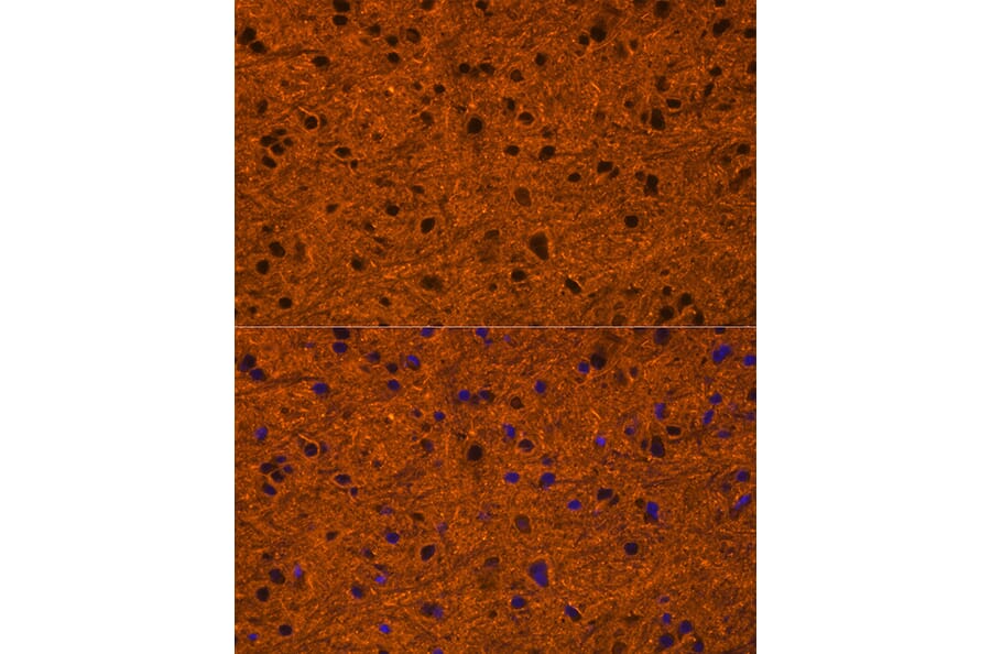 Immunofluorescence - Anti-PMCA1 Antibody (A308310) - Antibodies.com
