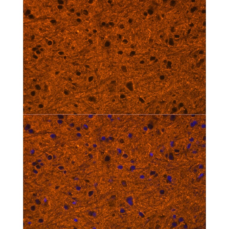 Immunofluorescence - Anti-PMCA1 Antibody (A308310) - Antibodies.com