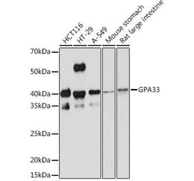 Western Blot - Anti-GPA33 Antibody [ARC2060] (A308311) - Antibodies.com