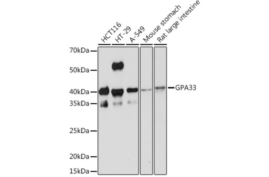 Western Blot - Anti-GPA33 Antibody [ARC2060] (A308311) - Antibodies.com