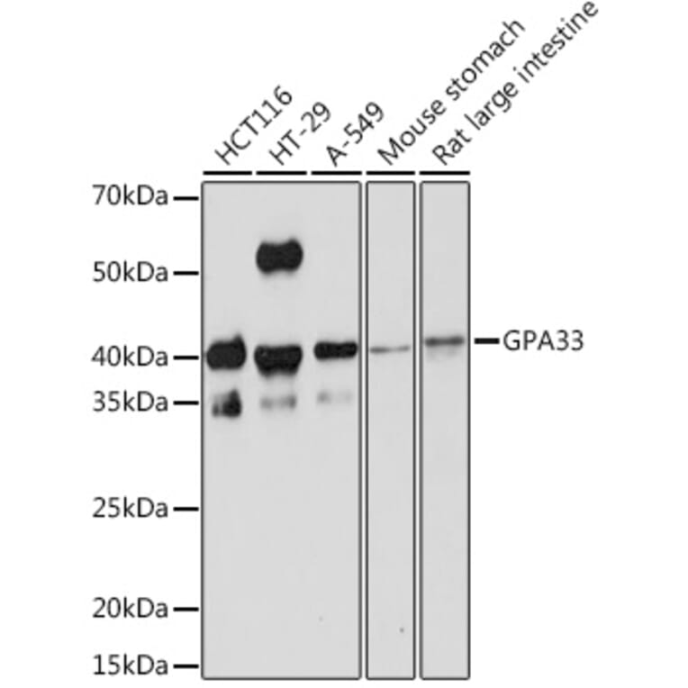 Western Blot - Anti-GPA33 Antibody [ARC2060] (A308311) - Antibodies.com