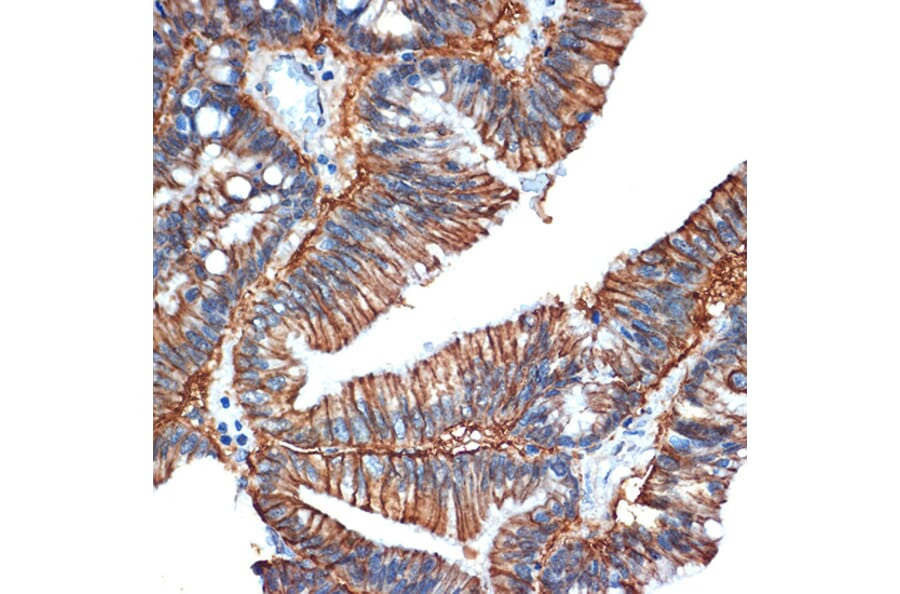 Immunohistochemistry - Anti-GPA33 Antibody [ARC2060] (A308311) - Antibodies.com