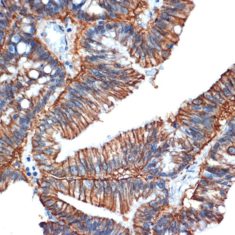 Immunohistochemistry - Anti-GPA33 Antibody [ARC2060] (A308311) - Antibodies.com