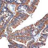 Immunohistochemistry - Anti-GPA33 Antibody [ARC2060] (A308311) - Antibodies.com