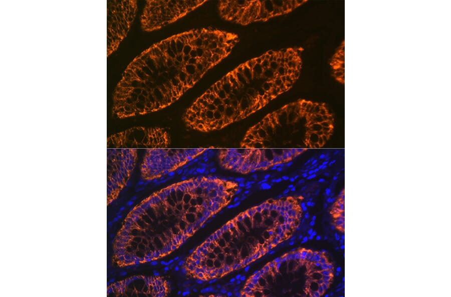 Immunofluorescence - Anti-GPA33 Antibody [ARC2060] (A308311) - Antibodies.com