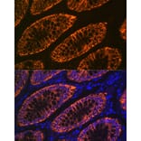 Immunofluorescence - Anti-GPA33 Antibody [ARC2060] (A308311) - Antibodies.com
