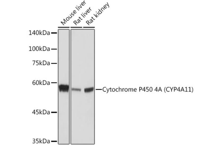 Western Blot - Anti-Cytochrome P450 4A/CYP4A11 Antibody [ARC2219] (A308313) - Antibodies.com