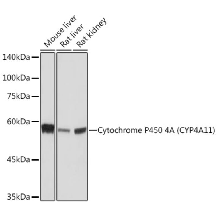 Western Blot - Anti-Cytochrome P450 4A/CYP4A11 Antibody [ARC2219] (A308313) - Antibodies.com