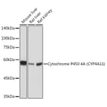 Western Blot - Anti-Cytochrome P450 4A/CYP4A11 Antibody [ARC2219] (A308313) - Antibodies.com