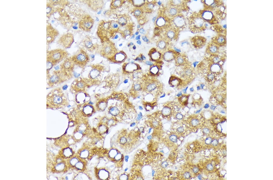 Immunohistochemistry - Anti-Cytochrome P450 4A/CYP4A11 Antibody [ARC2219] (A308313) - Antibodies.com