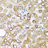 Immunohistochemistry - Anti-Cytochrome P450 4A/CYP4A11 Antibody [ARC2219] (A308313) - Antibodies.com