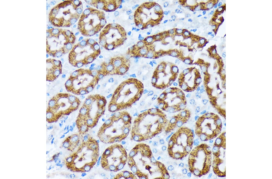 Immunohistochemistry - Anti-Cytochrome P450 4A/CYP4A11 Antibody [ARC2219] (A308313) - Antibodies.com