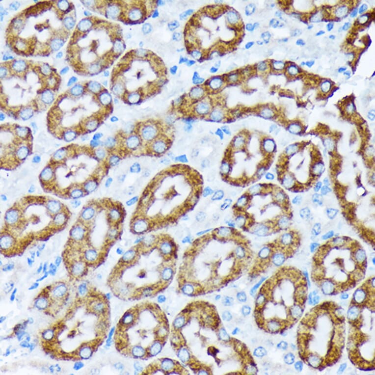 Immunohistochemistry - Anti-Cytochrome P450 4A/CYP4A11 Antibody [ARC2219] (A308313) - Antibodies.com