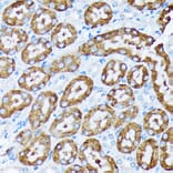 Immunohistochemistry - Anti-Cytochrome P450 4A/CYP4A11 Antibody [ARC2219] (A308313) - Antibodies.com