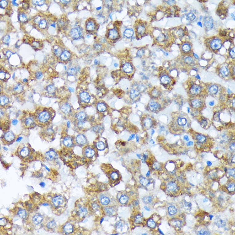 Immunohistochemistry - Anti-Cytochrome P450 4A/CYP4A11 Antibody [ARC2219] (A308313) - Antibodies.com