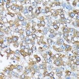 Immunohistochemistry - Anti-Cytochrome P450 4A/CYP4A11 Antibody [ARC2219] (A308313) - Antibodies.com
