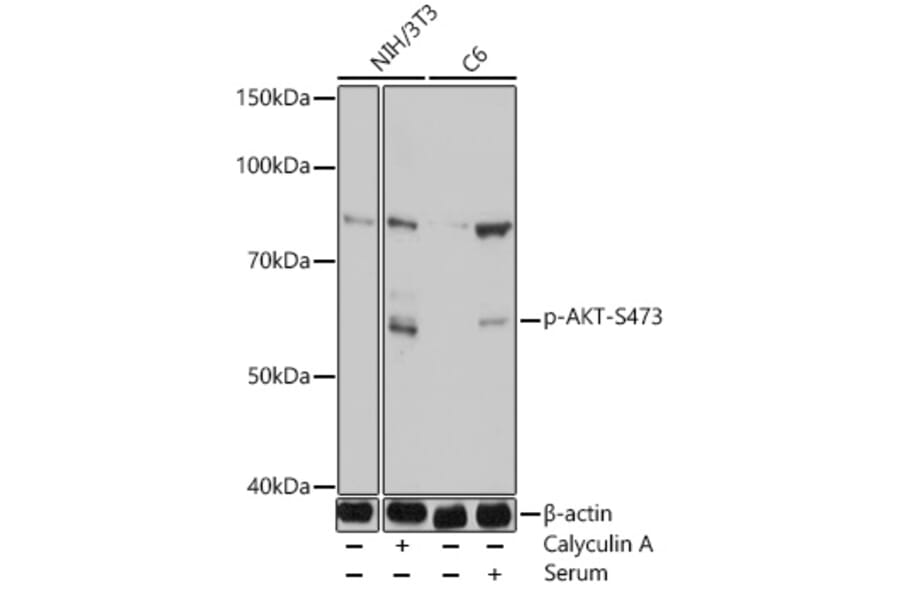 Western Blot - Anti-AKT1 +AKT2 + AKT3 (phospho Ser473) Antibody (A308315) - Antibodies.com