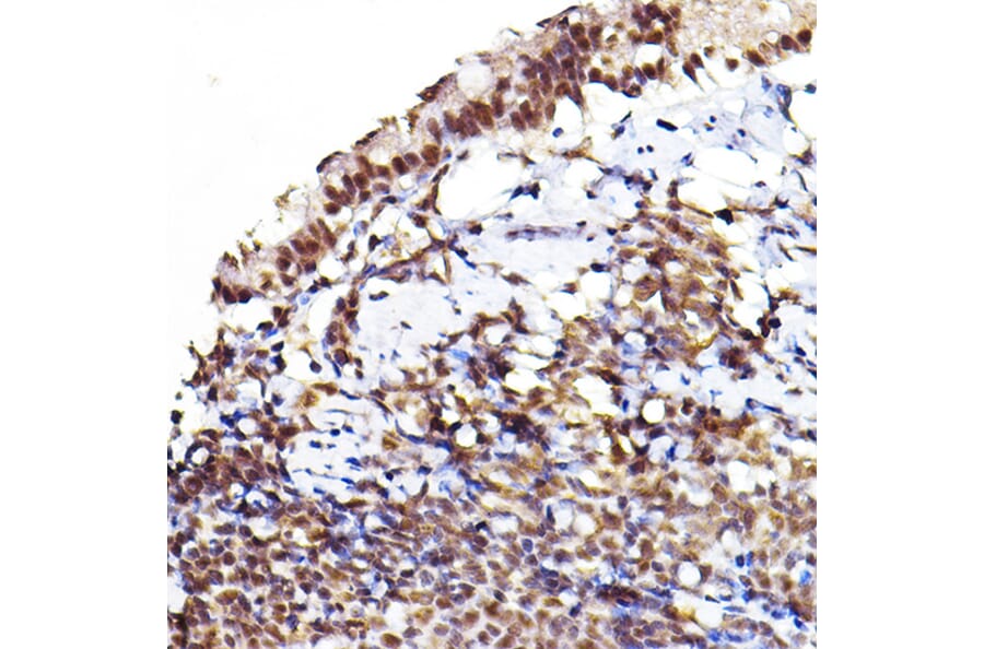 Immunohistochemistry - Anti-AKT1 +AKT2 + AKT3 (phospho Ser473) Antibody (A308315) - Antibodies.com