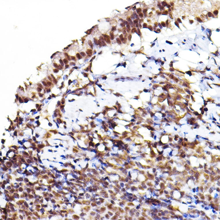 Immunohistochemistry - Anti-AKT1 +AKT2 + AKT3 (phospho Ser473) Antibody (A308315) - Antibodies.com