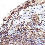 Immunohistochemistry - Anti-AKT1 +AKT2 + AKT3 (phospho Ser473) Antibody (A308315) - Antibodies.com